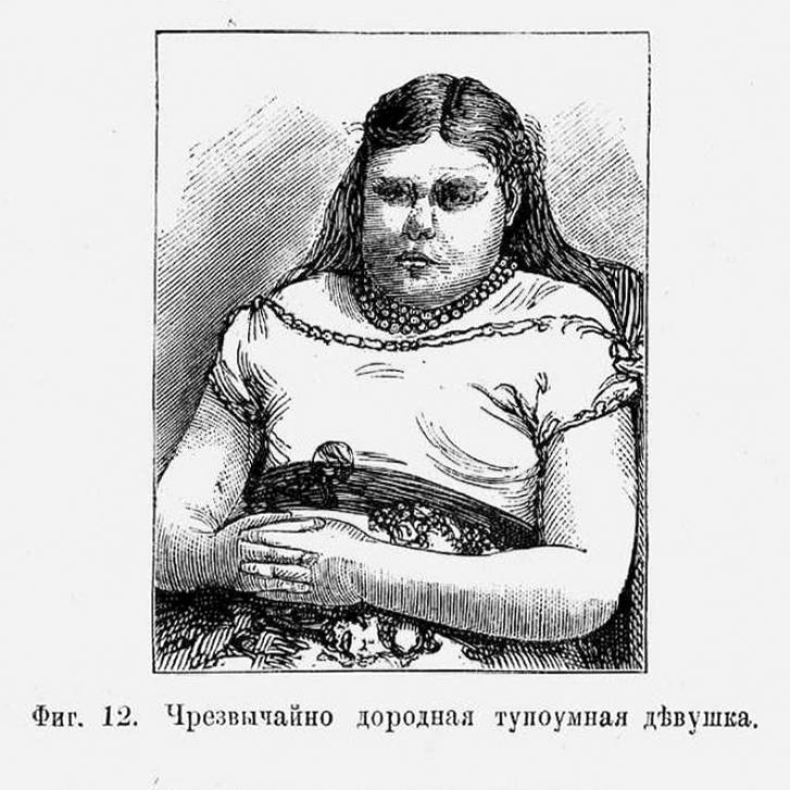 Чрезвычайно дородная тупоумная девушка